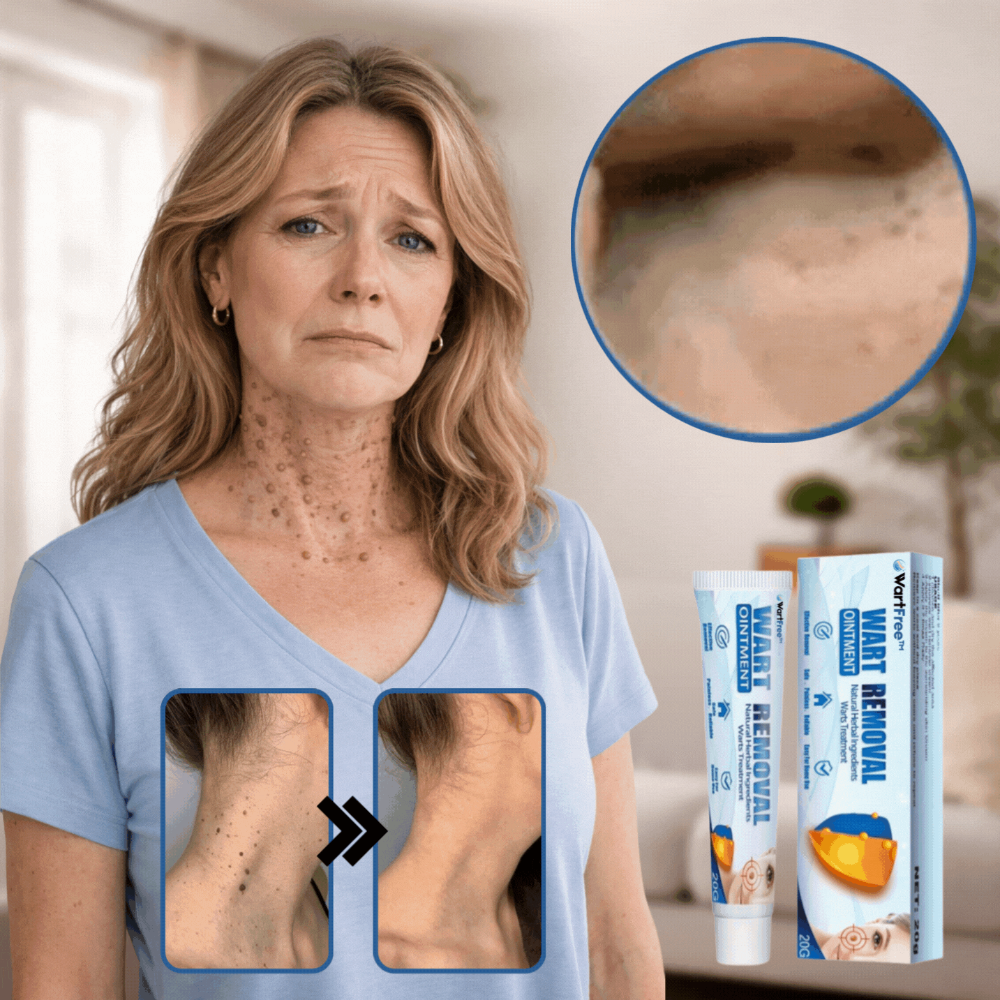 WartFree™ Wrattencrème product
